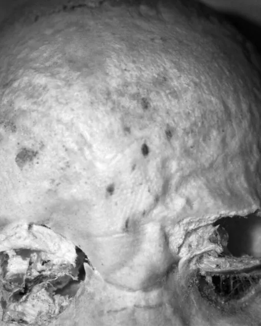 Татуированный лоб трехлетнего нубийского ребенка в инфракрасном свете. / Татуированный лоб трехлетнего нубийского ребенка в инфракрасном свете. /