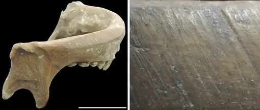 Человеческие кости Человеческие кости