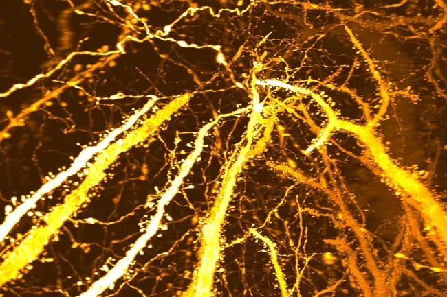 Нейробиологи обнаружили возможную причину шизофрении