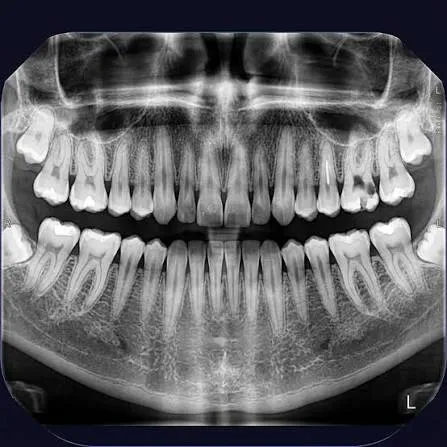 teeth scan teeth scan