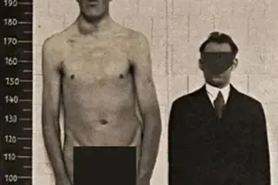 Он вырос от карлика до гиганта! Загадочная история Адама Райнера