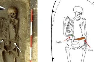 Поразительно! Воину из Средневековья ампутировали руку — и заменили ее ножом-протезом Поразительно! Воину из Средневековья ампутировали руку — и заменили ее ножом-протезом
