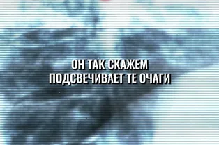 Может ли искусственный интеллект увидеть в медицинской карте или результатах анализов то, что пропустил человек? Может ли искусственный интеллект увидеть в медицинской карте или результатах анализов то, что пропустил человек?