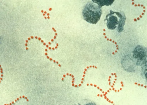 Streptococcus pyogenes — бактерии, которые Земмельвейс обнаружил у всех зараженных