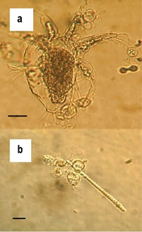 Batrachochytrium dendrobatidis на пресноводном рачке (a) и на водоросли (b). Относится к одному из древнейших видов грибков хитридиомицетам. Batrachochytrium dendrobatidis на пресноводном рачке (a) и на водоросли (b). Относится к одному из древнейших видов грибков хитридиомицетам.