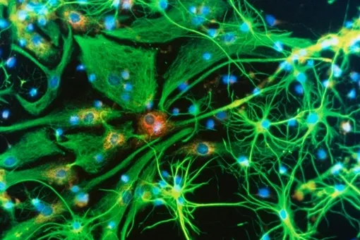 Разработаны методы генного редактирование смертельно опасных заболеваний мозга