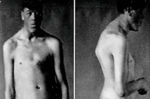 Адам Райнер сфотографировался для исследования своего неожиданного роста. /