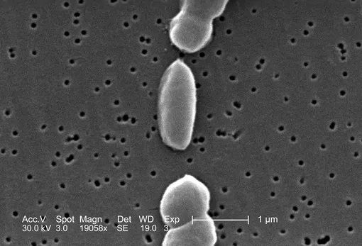 Vibrio parahaemolyticus Vibrio parahaemolyticus