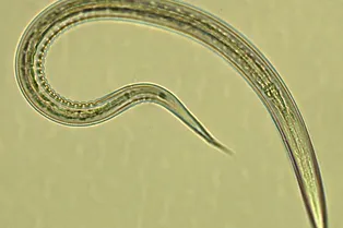 Заражение глистами вылечило диабет II типа и ряд кишечных инфекций: помощь от паразитов Заражение глистами вылечило диабет II типа и ряд кишечных инфекций: помощь от паразитов