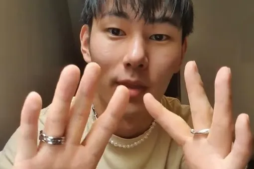 Блогер рассказал, как он живет без больших пальцев Блогер рассказал, как он живет без больших пальцев