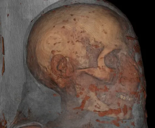 Сканы мумии