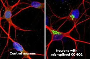 Ученые нашли причину перевозбуждения нейронов при БАС и ЛВД Ученые нашли причину перевозбуждения нейронов при БАС и ЛВД