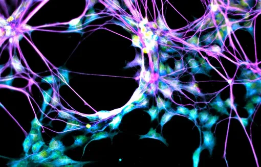 В процессе нейрогенеза нервные стволовые клетки (показанные здесь) могут превращаться в нейроны.