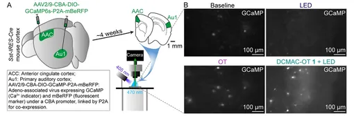 Оценка DCMAC-OT 1 ex vivo с помощью эпифлуоресцентной визуализации GCaMP. (A) Схема мест инъекции в кору головного мозга и эпифлуоресцентная визуализация GCaMP на срезах коры головного мозга мыши. (B) Примеры изображений, полученных при эпифлуоресцентной визуализации GCaMP ex vivo. Вверху слева: исходный уровень; внизу слева: положительный контроль с 1 мкМ OT; вверху справа: контроль с LED, сигнал GCaMP не регистрировался в течение 60 с при освещении светодиодом 405 нм без DCMAC-OT 1; внизу справа: сигналы GCaMP в течение 60 с после высвобождения 1 мкМ DCMAC-OT 1 при освещении светодиодом 405 нм. Оценка DCMAC-OT 1 ex vivo с помощью эпифлуоресцентной визуализации GCaMP. (A) Схема мест инъекции в кору головного мозга и эпифлуоресцентная визуализация GCaMP на срезах коры головного мозга мыши. (B) Примеры изображений, полученных при эпифлуоресцентной визуализации GCaMP ex vivo. Вверху слева: исходный уровень; внизу слева: положительный контроль с 1 мкМ OT; вверху справа: контроль с LED, сигнал GCaMP не регистрировался в течение 60 с при освещении светодиодом 405 нм без DCMAC-OT 1; внизу справа: сигналы GCaMP в течение 60 с после высвобождения 1 мкМ DCMAC-OT 1 при освещении светодиодом 405 нм.