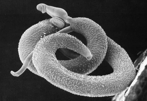 Schistosoma mansoni. Schistosoma mansoni.