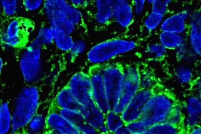 Ученые впервые искусственно создали функционирующую почку Ученые впервые искусственно создали функционирующую почку