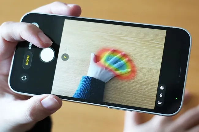 ИИ научился выявлять опасное гормональное заболевание по фотографии руки