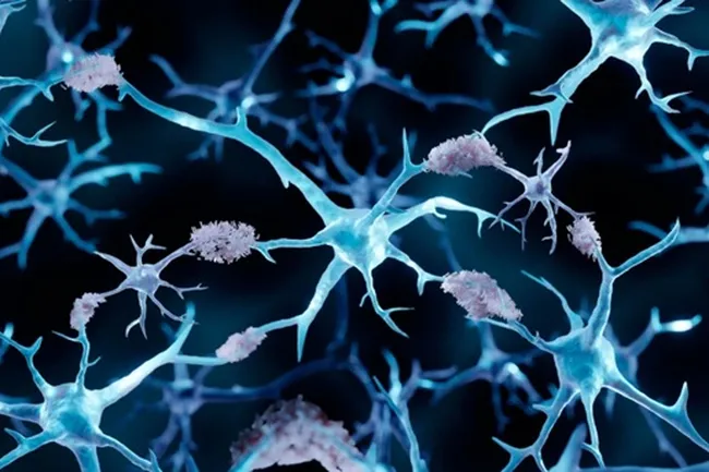 Ученые показали, почему раковые больные редко болеют Альцгеймером