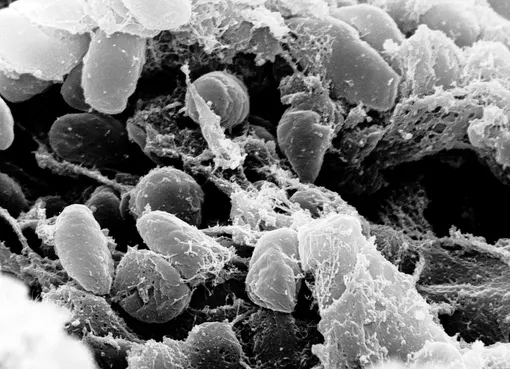 Чумная палочка (Yersinia pestis), электронная микрофотография