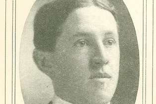 Пугающая история! Он выпил столько радия, что его череп буквально «развалился»