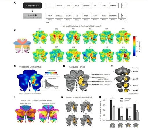 Области мозжечка, отвечающие за речь и язык.