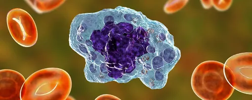 Макрофаги атакуют солидную опухоль. Макрофаги атакуют солидную опухоль.