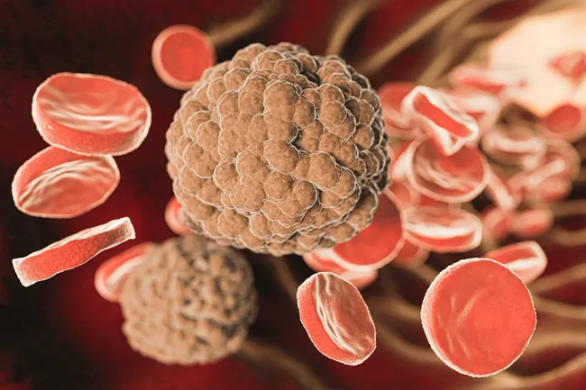 Большинство людей с геном высокого уровня холестерина не знают, что он у них есть