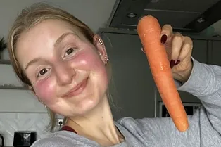 Ее кожа пожелтела якобы из-за переедания моркови! Странная история преображения