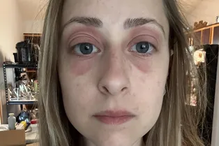 Дом с плесенью разрушил здоровье и брак молодой пары в США