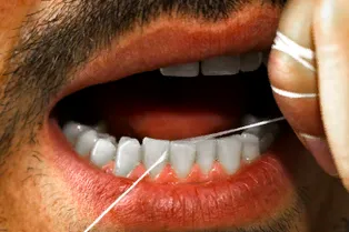 Бактерии во рту могут быть причиной болезни Крона — ученые в недоумении Бактерии во рту могут быть причиной болезни Крона — ученые в недоумении