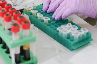 Число заболевших корью стало рекордным за 23 года Число заболевших корью стало рекордным за 23 года