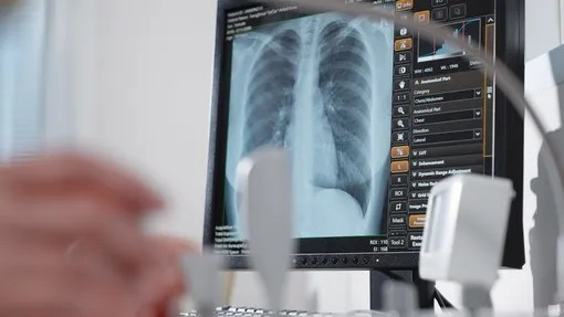 снимок лучевой диагностики