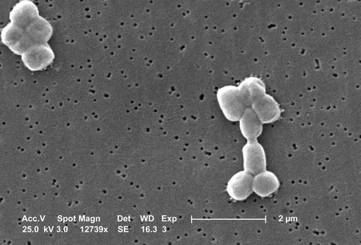 Устойчивая к антибиотикам бактерия Acinetobacter baumannii. Устойчивая к антибиотикам бактерия Acinetobacter baumannii.