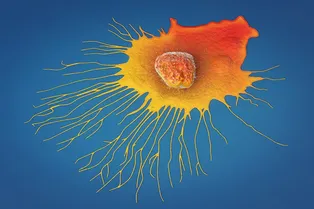 Ученые показали, как раковые клетки проникает в мозг, и как их остановить Ученые показали, как раковые клетки проникает в мозг, и как их остановить