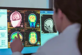 Мозг взрослеет до 32 лет: ученые выделили пять фаз его развития