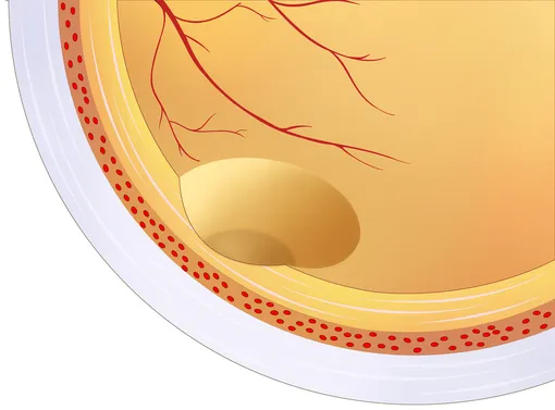 Желтое пятно сетчатки глаза, схематичное изображение