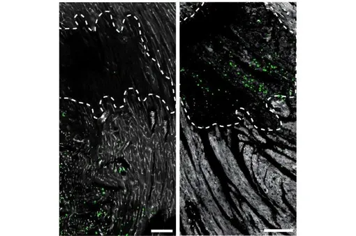 нейтрофилы