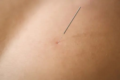 микронидлинг