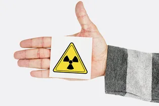 Хисаши Оучи: японец, который перенес самые тяжелые в истории радиационные ожоги в истории и прожил с ними 83 дня Хисаши Оучи: японец, который перенес самые тяжелые в истории радиационные ожоги в истории и прожил с ними 83 дня