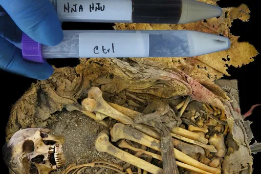 Микробы времени: что скрывает кишечник человека, жившего 1000 лет назад Микробы времени: что скрывает кишечник человека, жившего 1000 лет назад