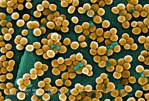 Золотистый стафилококк. Staphylococcus aureus.