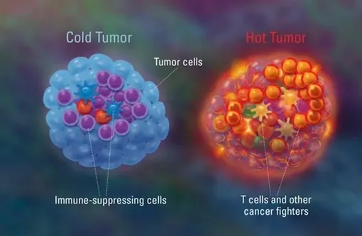 Холодная и горячая опухоли.