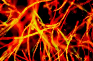 Эти грибы смогли обмануть смерть — веками они изобретали способ, который сделал их бессмертными Эти грибы смогли обмануть смерть — веками они изобретали способ, который сделал их бессмертными