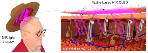 схема воздействия