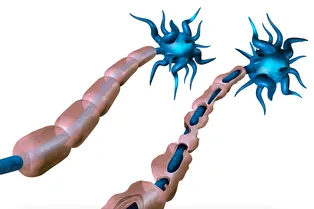 Антигистаминные препараты могут устранять повреждения нервов при рассеянном склерозе