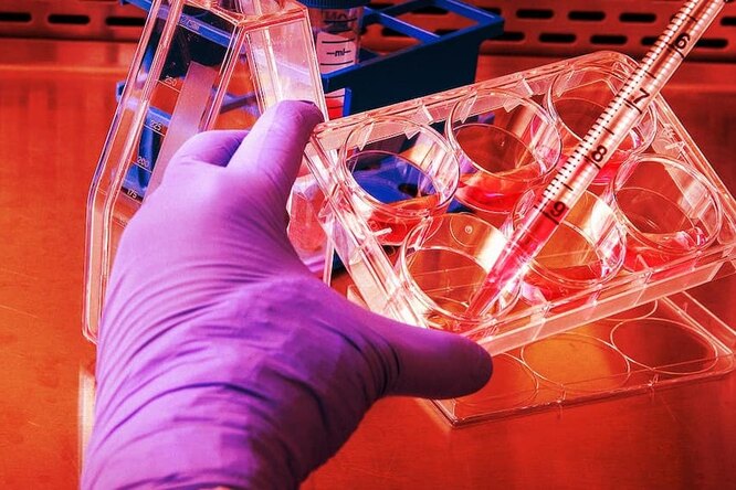 Насколько опасна оспа обезьян и почему все о ней говорят: в этом вирусе странно буквально всё