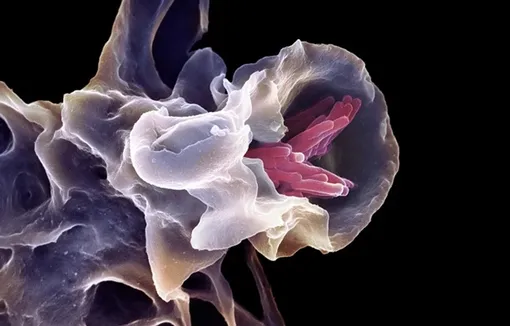 Макрофаг — клетка «первой помощи» в системе врожденного иммунитета — в процессе поглощения бактерии Mycobacterium tuberculosis. Макрофаг — клетка «первой помощи» в системе врожденного иммунитета — в процессе поглощения бактерии Mycobacterium tuberculosis.