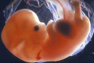 Мозг знает, как устроен мир, еще до рождения человека