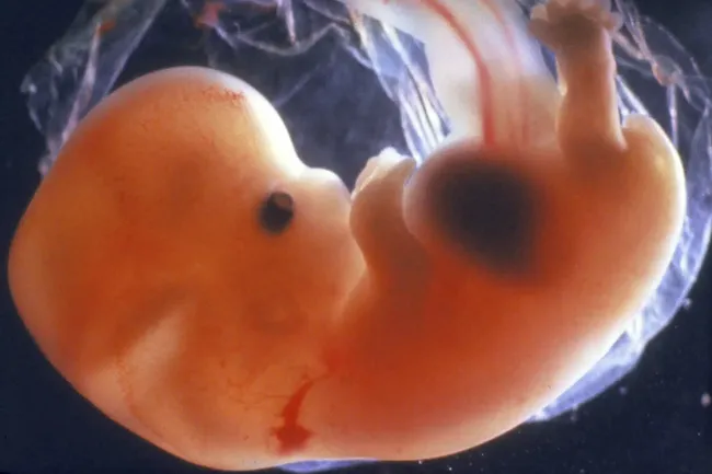 Мозг знает, как устроен мир, еще до рождения человека