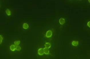 В древнеримских ночных горшках нашли следы редких паразитов